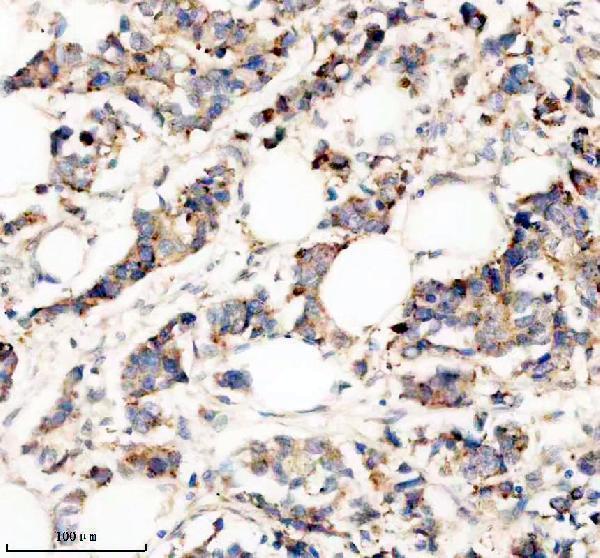 a08165 2 fzd9 primary antibodies ihc testing 1