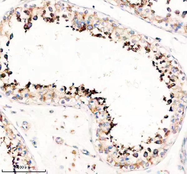 a08165 2 fzd9 primary antibodies ihc testing 2