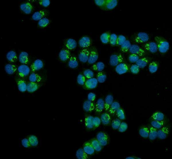 a08167 1 hoxc13 primary antibodies if testing 2