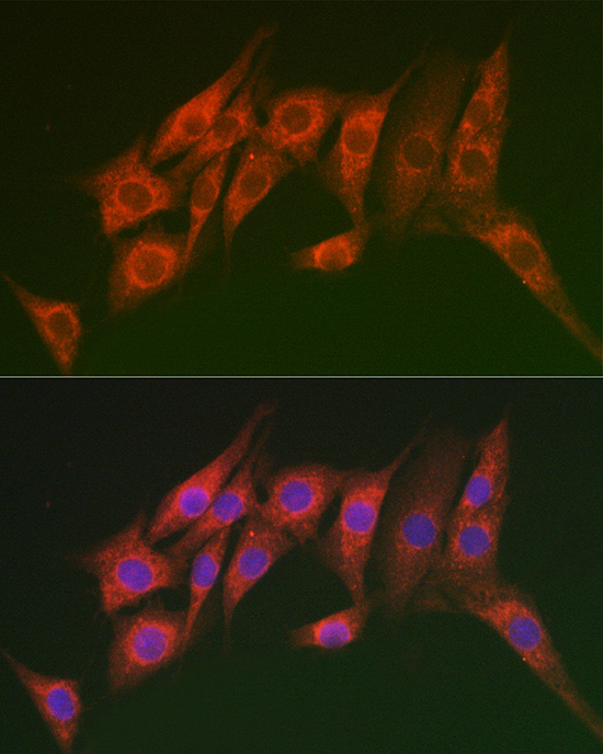 Immunofluorescence analysis of NIH/3T3 cells using MTMR14 Rabbit pAb  at dilution of 1:100 