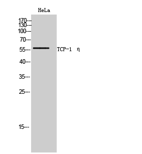 a08169 1 cct7 primary antibodyes wb testing 1