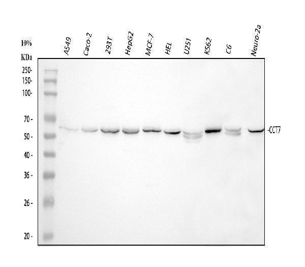  Western blot analysis of CCT7 using anti-CCT7 antibody (A08169-2)