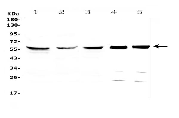 Western blot analysis of CCT7 using anti-CCT7 antibody (A08169-2). Electrophoresis was performed on a 5-20% SDS-PAGE gel at 70V (Stacking gel) / 90V (Resolving gel) for 2-3 hours. The sample well of each lane was loaded with 50ug of sample under reducing conditions. Lane 1: human Hela whole cell lysates, Lane 2: human HepG2 whole cell lysates, Lane 3: human MDA-MB-231 whole cell lysates, Lane 4: rat testis tissue lysates, Lane 5: mouse testis tissue lysates. After Electrophoresis, proteins were transferred to a Nitrocellulose membrane at 150mA for 50-90 minutes. Blocked the membrane with 5% Non-fat Milk/ TBS for 1.5 hour at RT. The membrane was incubated with rabbit anti-CCT7 antigen affinity purified polyclonal antibody (Catalog # A08169-2) at 0.5 μg/mL overnight at 4°C, then washed with TBS-0.1%Tween 3 times with 5 minutes each and probed with a goat anti-rabbit IgG-HRP secondary antibody at a dilution of 1:10000 for 1.5 hour at RT. The signal is developed using an Enhanced Chemiluminescent detection (ECL) kit (Catalog # EK1002) with Tanon 5200 system. A specific band was detected for CCT7 at approximately 59KD. The expected band size for CCT7 is at 59KD.