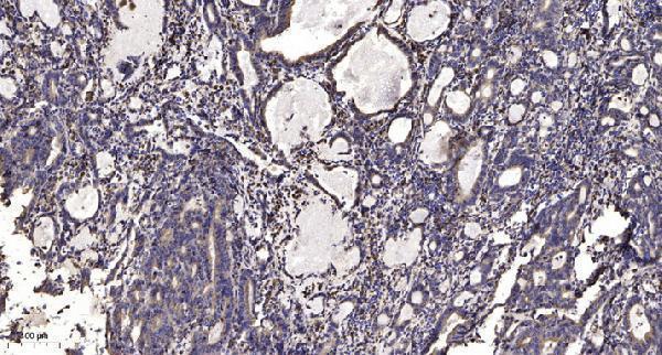 a08171 alpk1 primary antibodies ihc testing 1