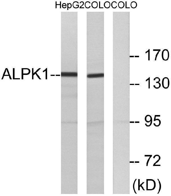 a08171 alpk1 primary antibodies wb testing 3