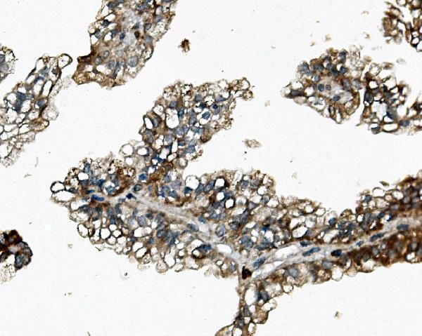 a08177 1 zfp42 primary antibodies ihc testing 3