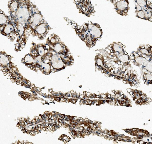 a08177 1 zfp42 primary antibodies ihc testing 4