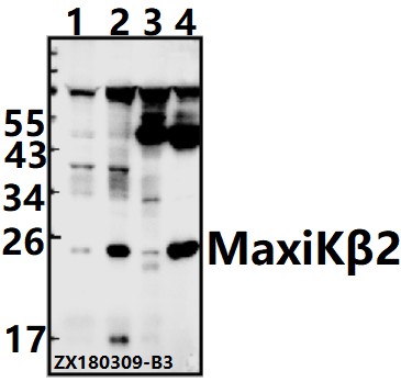 Western blot (WB) analysis of MaxiKβ2 (I186) pAb at 1:500 dilution
Lane1:SK-OVCAR3 whole cell lysate(40ug)
Lane2:A2780 whole cell lysate(40ug)
Lane3:The Ovary tissue lysate of Rat(40ug)
Lane4:The Brain tissue lysate of Mouse(40ug)