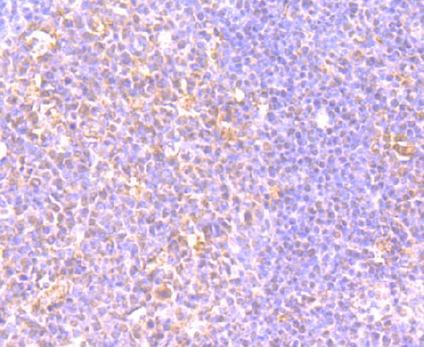 Immunohistochemical analysis of paraffin-embedded human tonsil tissue using anti-LY75 antibody