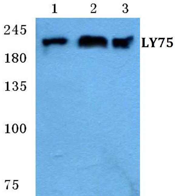 Western blot (WB) analysis of LY75 polyclonal antibody at 1:500 dilution
Lane1:MCF-7 cell lysate
Lane2:sp2/0 cell lysate
Lane3:H9C2 cell lysate
