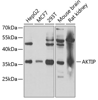 WesternBlot (WB) analysis of AKTIP polyclonal antibody
