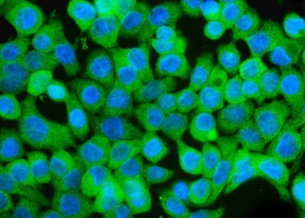 a08185 3 gchfr primary antibodies if testing 5