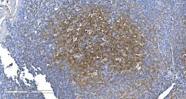  IHC analysis of GCHFR using anti-GCHFR antibody (A08185-3)