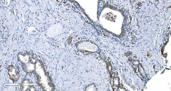  IHC analysis of GCHFR using anti-GCHFR antibody (A08185-3)