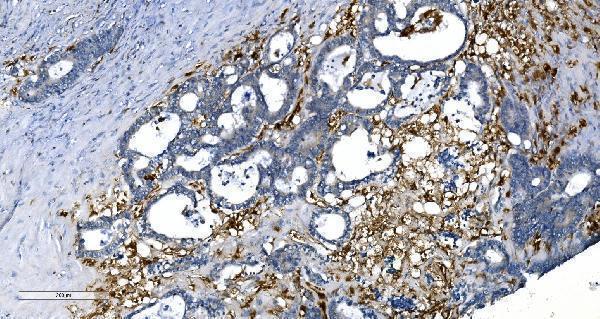 a08185 3 gchfr primary antibodies ihc testing 4