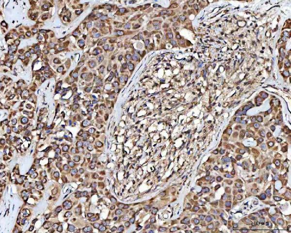  IHC analysis of MECR using anti-MECR antibody (A08189-1)