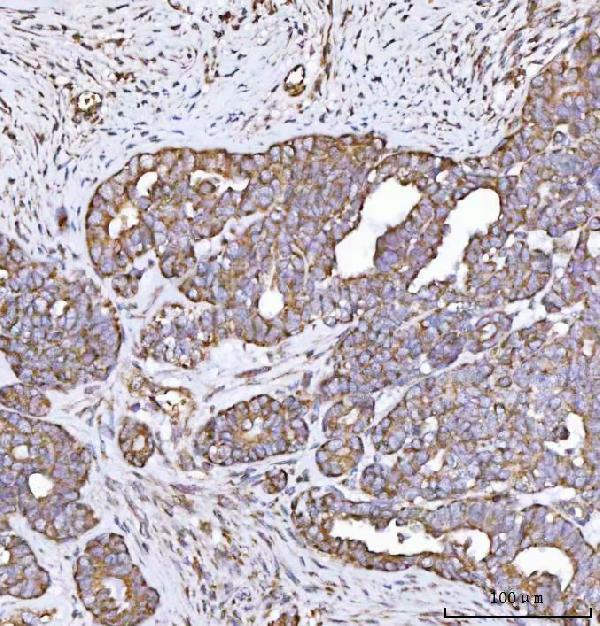  IHC analysis of MECR using anti-MECR antibody (A08189-1)