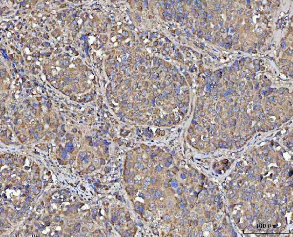 a08189 1 mecr primary antibodies ihc testing 4