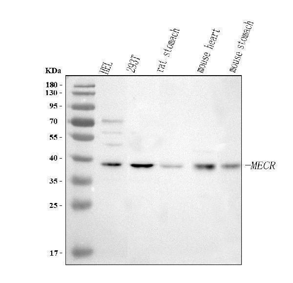  Western blot analysis of MECR using anti-MECR antibody (A08189-1)