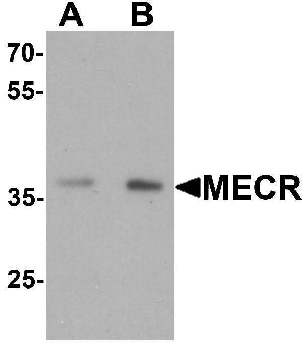 a08189 mecr primary antibodies wb testing 1