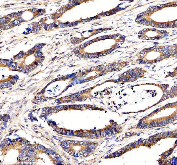 a08193 1 pacs2 primary antibodies ihc testing 2