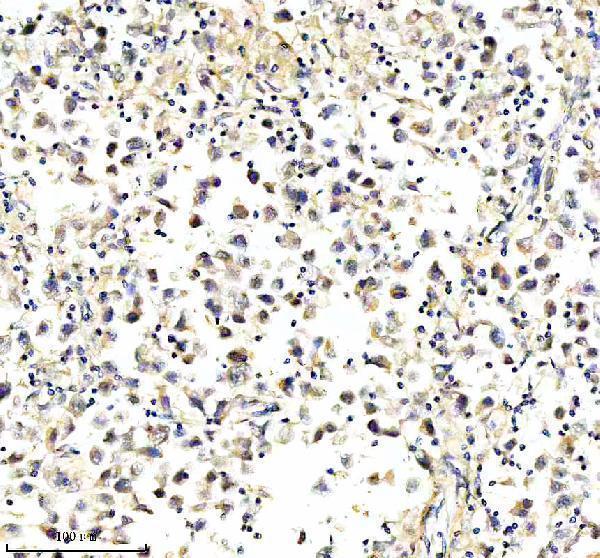 a08193 1 pacs2 primary antibodies ihc testing 3