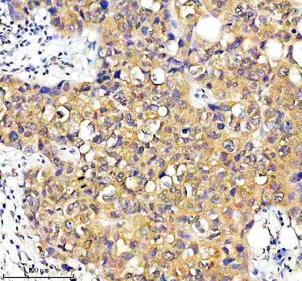 a08193 1 pacs2 primary antibodies ihc testing 5