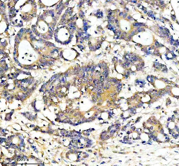 a08193 1 pacs2 primary antibodies ihc testing 6