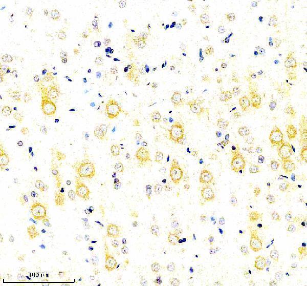 a08193 1 pacs2 primary antibodies ihc testing 7