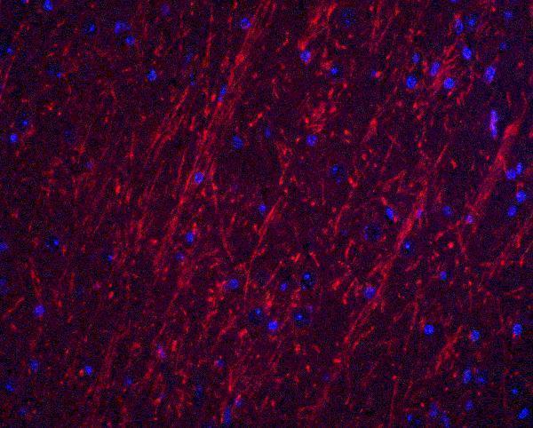 Immunofluorescence of PACS2 in mouse brain tissue with PACS2 antibody at 20 μg/ml