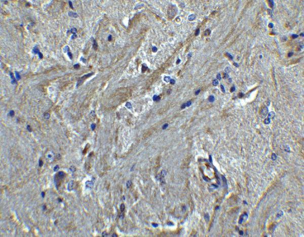 Immunohistochemistry of PACS2 in mouse brain tissue with PACS2 antibody at 5 μg/mL