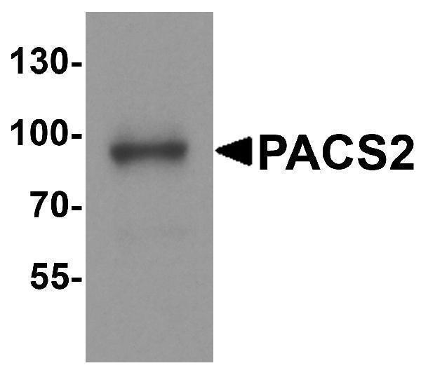 Western blot analysis of PACS2 in mouse brain tissue lysate with PACS2 antibody at 1 μg/ml