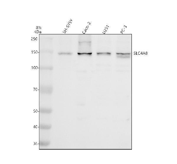 Western blot analysis of SLC4A8 using anti-SLC4A8 antibody (A08194-2)