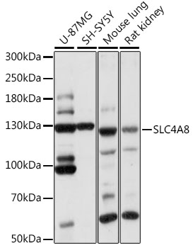 Western blot analysis of extracts of various cell lines, using SLC4A8 antibody  at 1:1000 dilution