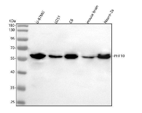  Western blot analysis of PHF10 using anti-PHF10 antibody (A08195-1)