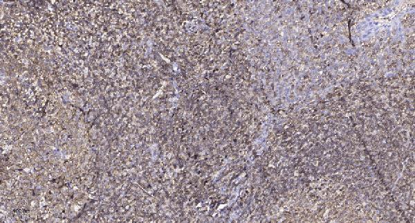 a08196 1 lipi primary antibodies ihc testing 1