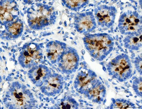 a08198 1 atp4a primary antibodies ihc testing 2