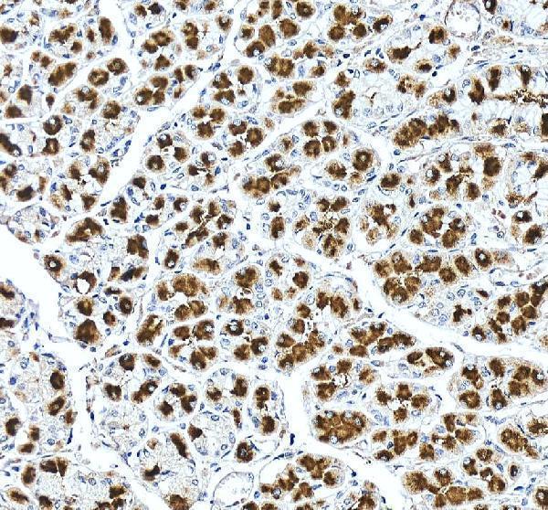 IHC analysis of ATP4A using anti-ATP4A antibody (A08198-1)