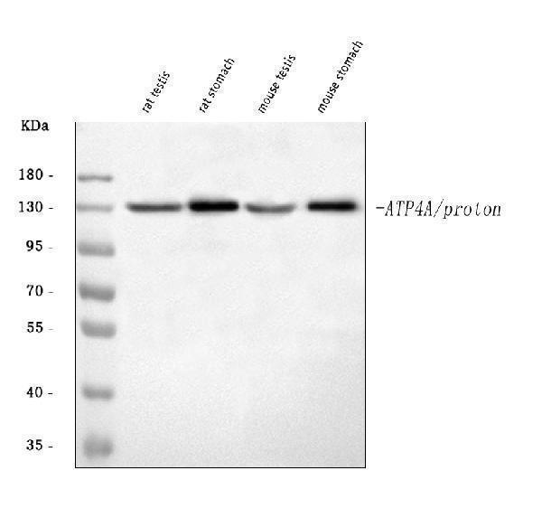  Western blot analysis of ATP4A using anti-ATP4A antibody (A08198-1)