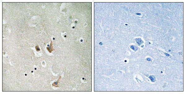 Immunohistochemistry analysis of paraffin-embedded human brain tissue, using CKS2 Antibody