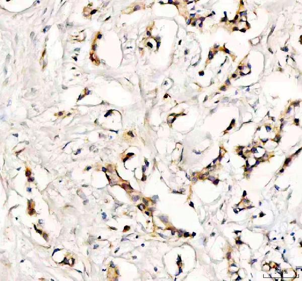 IHC analysis of SYNJ2 using anti-SYNJ2 antibody (A08206-1)