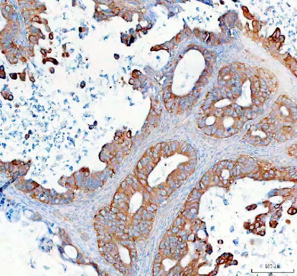 a08206 1 synj2 primary antibodies ihc testing 2