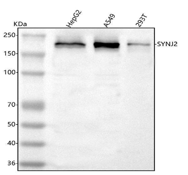  Western blot analysis of SYNJ2 using anti-SYNJ2 antibody (A08206-1)
