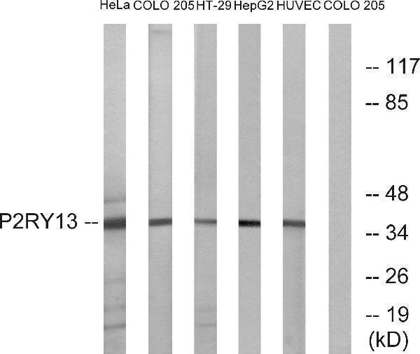 a08207 p2ry13 primary antibodies wb testing 1