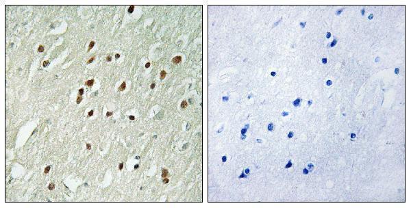 a08210 1 cntrob primary antibodies ihc testing 1