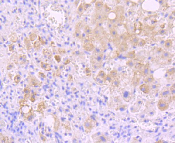 a08212 1 insrr primary antiboties ihc testing 1