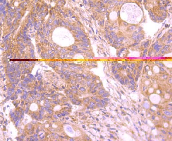 a08212 1 insrr primary antiboties ihc testing 2