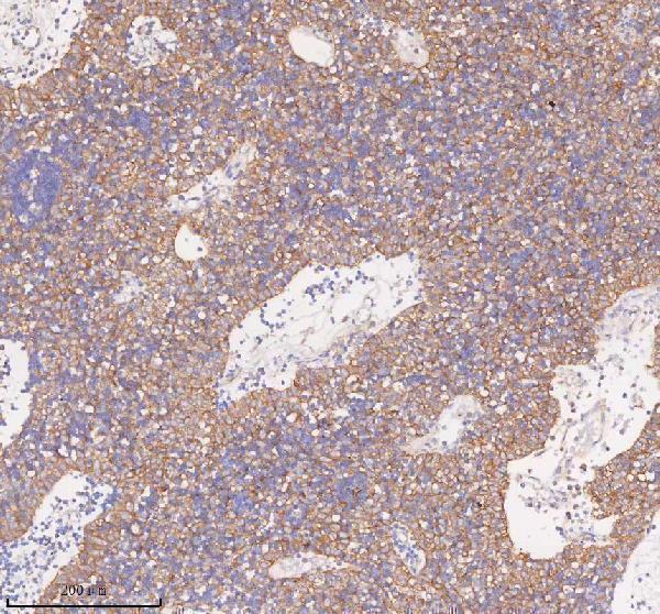 a08215 1 scamp3 primary antibodies ihc testing 10