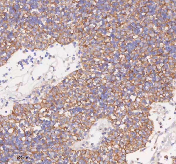 a08215 1 scamp3 primary antibodies ihc testing 11