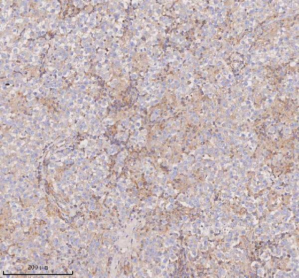 a08215 1 scamp3 primary antibodies ihc testing 12